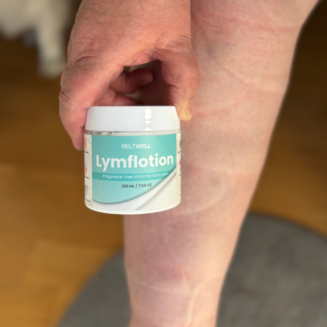 Lymfolotion - Fragrance-Free Non-Greasy Anti-Itch Lotion